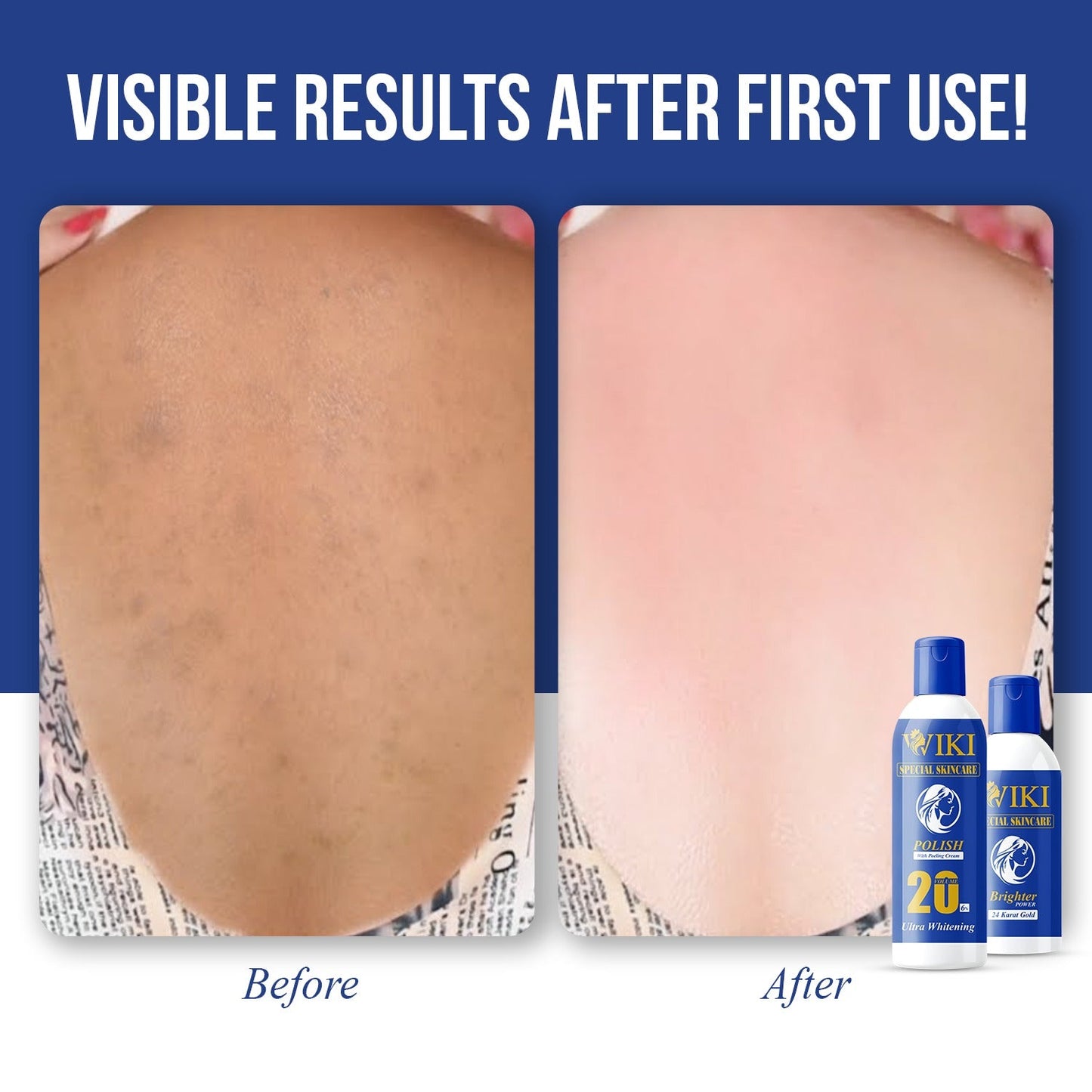 Wiki Skin Polish