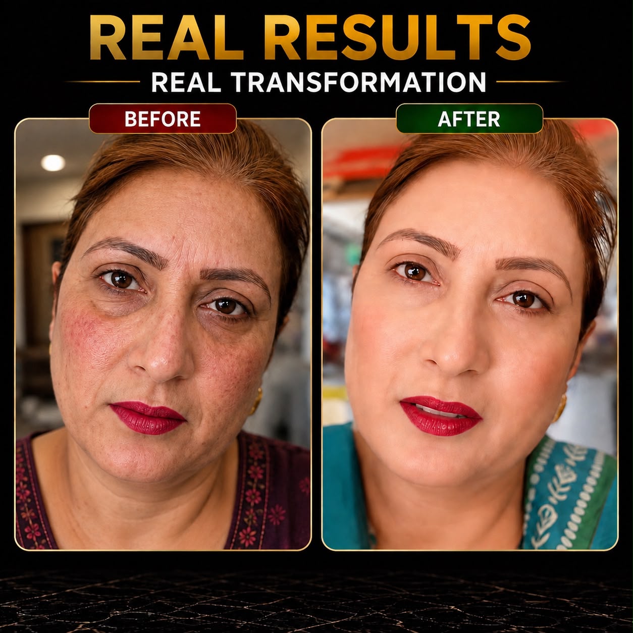 Buy Wiki Beauty Cream Get Wiki Serum Free